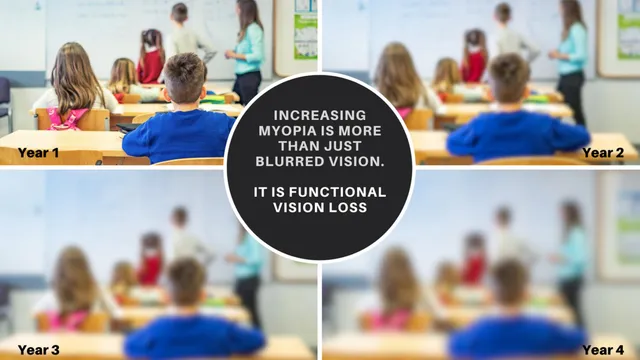 Crystal Clear Futures: Navigating the Impact of Untreated Myopia in Kids