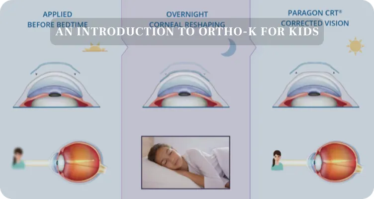 How Does Ortho-k Work? video preview