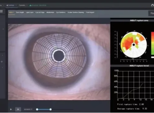 Non-invasive tear break-up time surface stability mapping