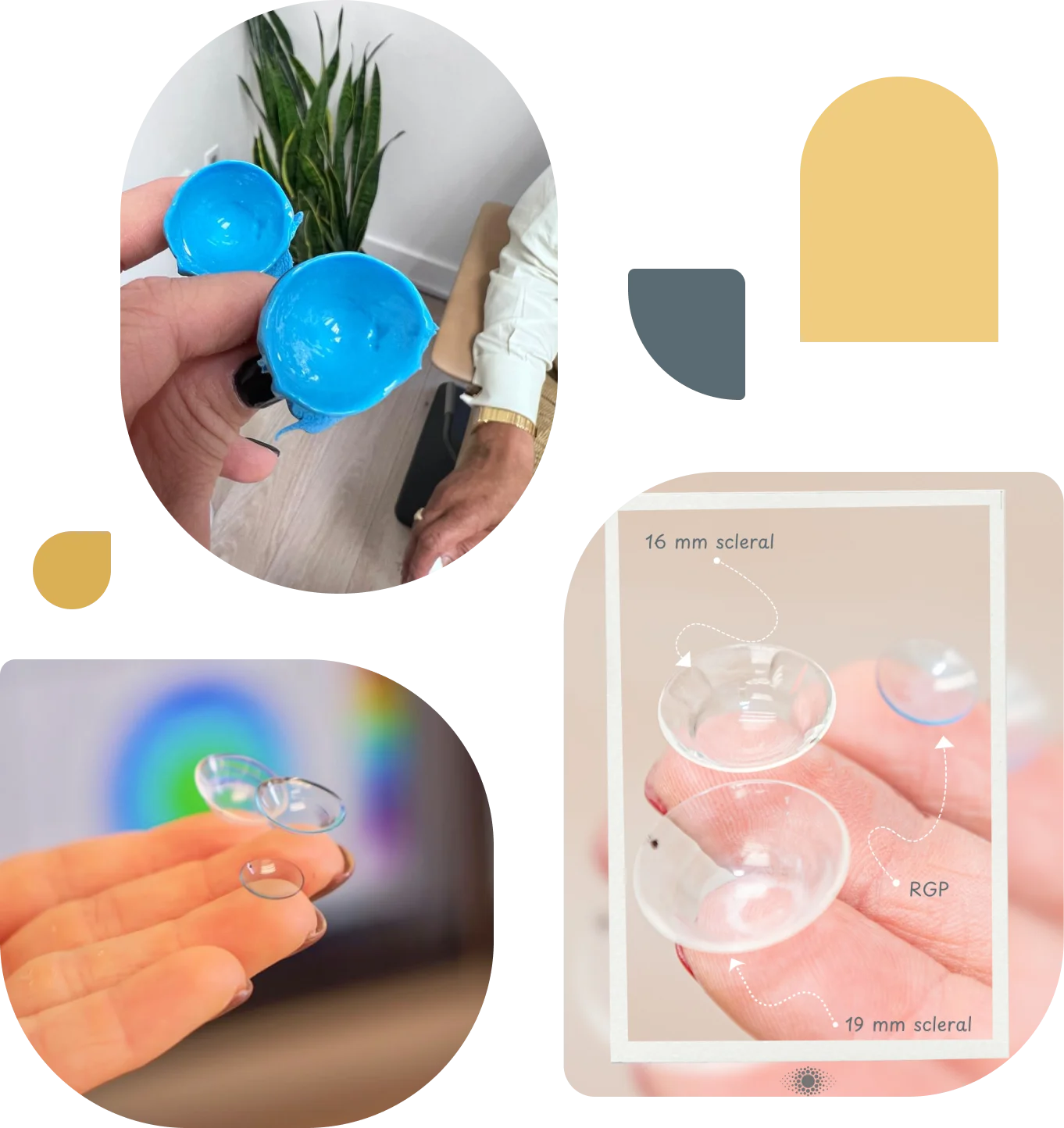 Specialty contact lenses