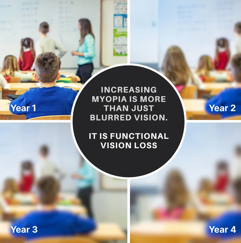 What is Myopia?